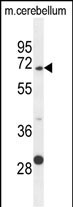 1 - GPC5 Antibody (N-term) AP10678a