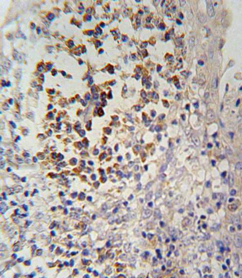 14 - IL12_2 Antibody (C-term) AP10687B