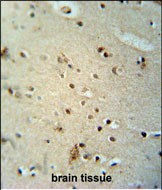 14 - CIC Antibody (N-term) AP10705a