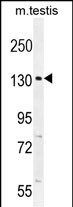 1 - CIC Antibody (N-term) AP10705a