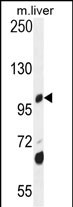 1 - DHTKD1 Antibody (Center) AP10715C