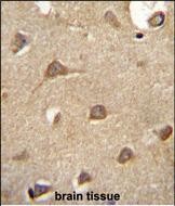 14 - ENTPD3 Antibody (C-term) AP10716b