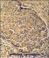 14 - IGSF1 Antibody (C-term) AP10732b