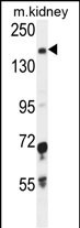 1 - IGSF1 Antibody (C-term) AP10732b