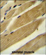 14 - RPH3AL Antibody (C-term) AP10741b