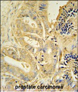 14 - TLL1 Antibody (C-term) AP10755b