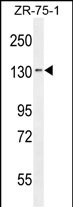 1 - TLL1 Antibody (C-term) AP10755b
