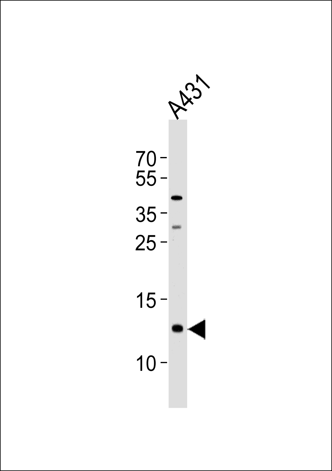 1 - SPRR2A Antibody (C-term) AP10758b