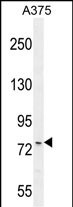 1 - ANR44 Antibody  (Center) AP10778c