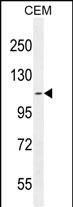 1 - AT8B2 Antibody  (N-term) AP10779a