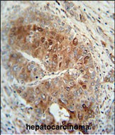 14 - CR1L Antibody  (C-term) AP10787b