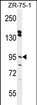 1 - ERMP1 Antibody  (C-term) AP10790b