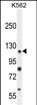 1 - ANR52 Antibody  (N-term) AP10808a