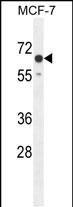 1 - CO027 Antibody  (C-term) AP10811b