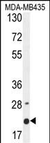 1 - M4A4A Antibody  (N-term) AP10816A