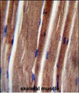 14 - THUM3 Antibody  (Center) AP10820c