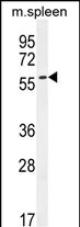 1 - CE037 Antibody  (C-term) AP10821b