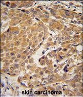 14 - AWAT2 Antibody  (C-term) AP10826B