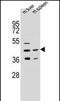 1 - AWAT2 Antibody  (C-term) AP10826B