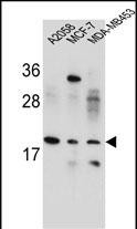 1 - VCX1 Antibody  (N-term) AP10827a