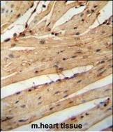 14 - LARP6 Antibody  (N-term) AP10830A