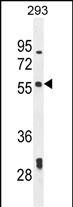 1 - LARP6 Antibody  (N-term) AP10830A