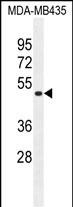 1 - TAPT1 Antibody  (C-term) AP10831b