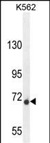 1 - DPY19L1 Antibody (C-term) AP10859b