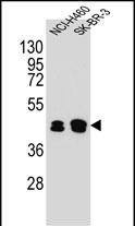 1 - KRT80 Antibody (C-term) AP10874b