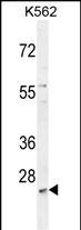 1 - MCART2 Antibody (N-term) AP10890a