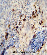 14 - LCE1A Antibody (C-term) AP10891b
