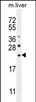 1 - CLEC2L Antibody (N-term) AP10911a