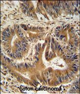 14 - VPS52 Antibody (C-term) AP10925b
