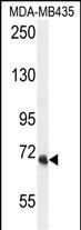 1 - VPS52 Antibody (C-term) AP10925b