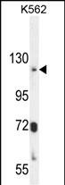 1 - ATP8A2 Antibody (N-term) AP10934a