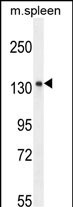 1 - K1199 Antibody (C-term) AP10964B