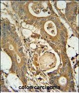 14 - GCNT3 Antibody (C-term) AP10975b