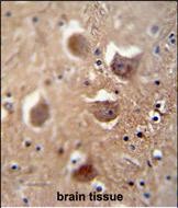 14 - TDRD7 Antibody (C-term) AP10982b