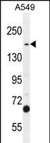 1 - TDRD7 Antibody (C-term) AP10982b