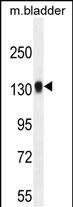 1 - TDRD7 Antibody (C-term) AP10982b
