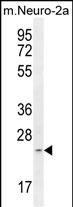 1 - RT34 Antibody (N-term) AP10991a
