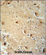 14 - TBC14 Antibody (Center) AP10993c