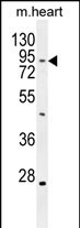 1 - TBC14 Antibody (Center) AP10993c