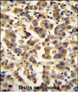 14 - TTC39B Antibody (C-term) AP11019b