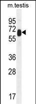 1 - TTC39B Antibody (C-term) AP11019b