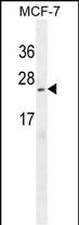 1 - CI150 Antibody  (N-term) AP11051a