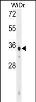 1 - WDR5B Antibody  (N-term) AP11053a
