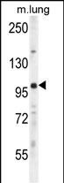 1 - UNK Antibody  (N-term) AP11082a