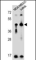 1 - KIR2DL2 Antibody (C-Term) AP5762d