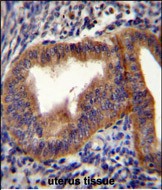 14 - CCNB1 Antibody (Center) AP11096c